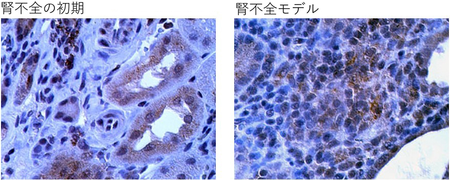 【図２】腎不全モデルにおけるリンパ球（青）の増殖とカリウムチャネル（Kv1.3） （茶）の過剰発現（文献： Kazama I. et al. Nephron Exp Nephrol 2014より引用）