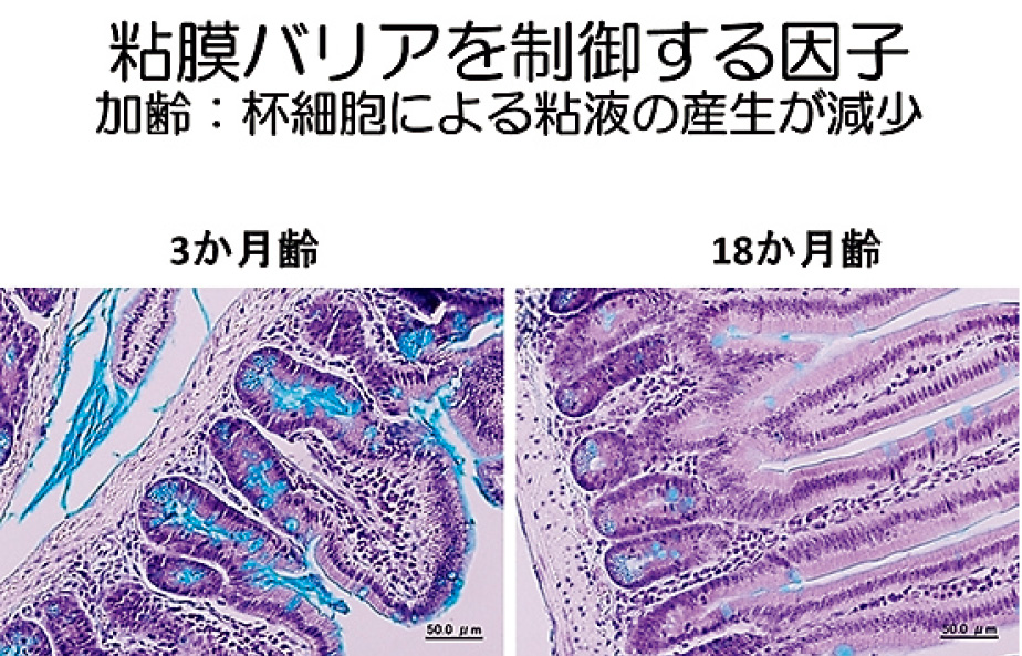 消化管の病理組織解析の例