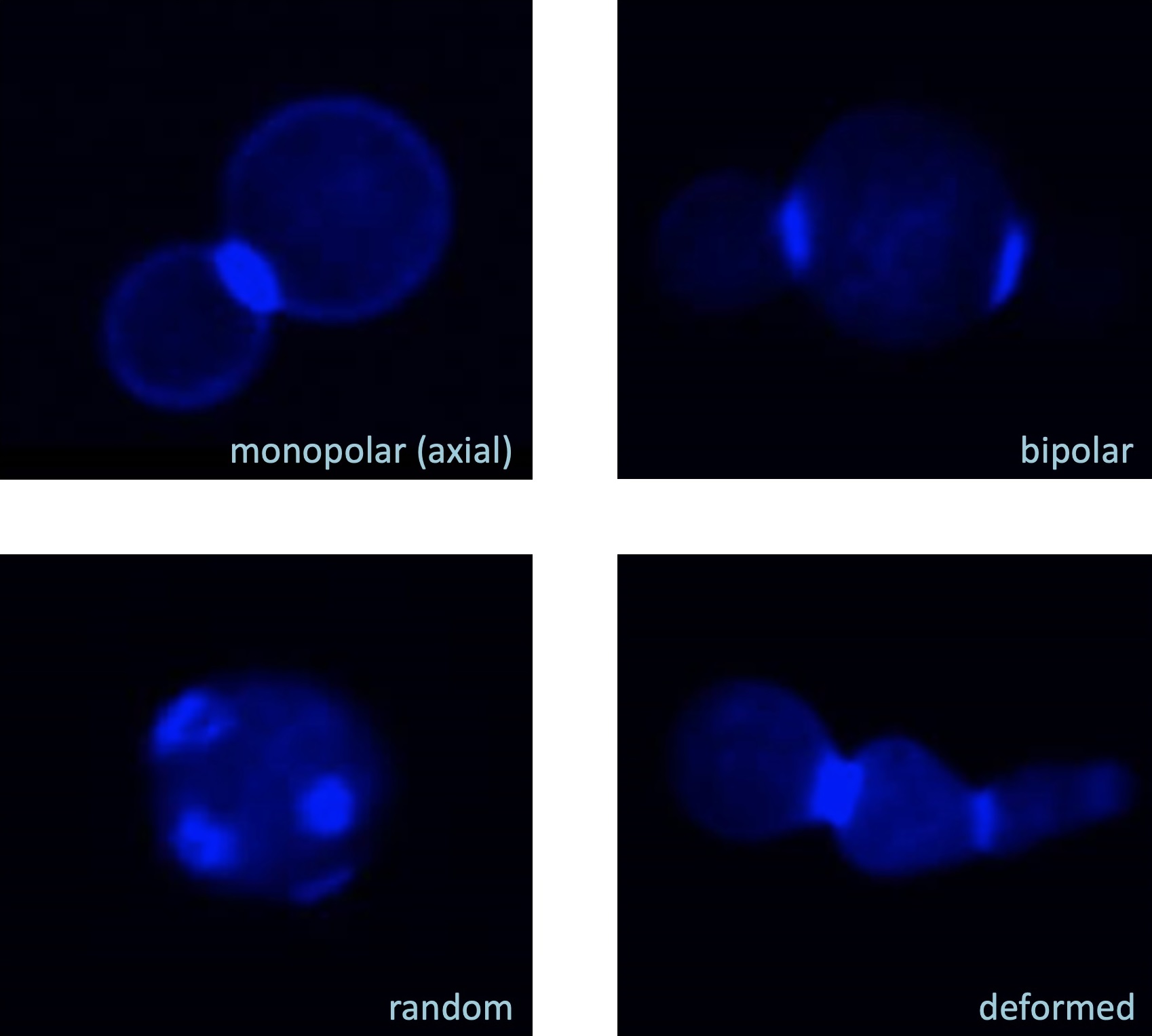 HM-1キラートキシンの感受性酵母細胞への影響
